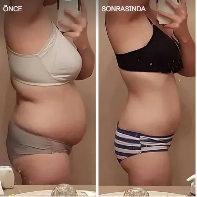 Slimvica™ 3’lü Deluxe